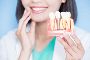 Dentist smiling and holding a model of a dental implant